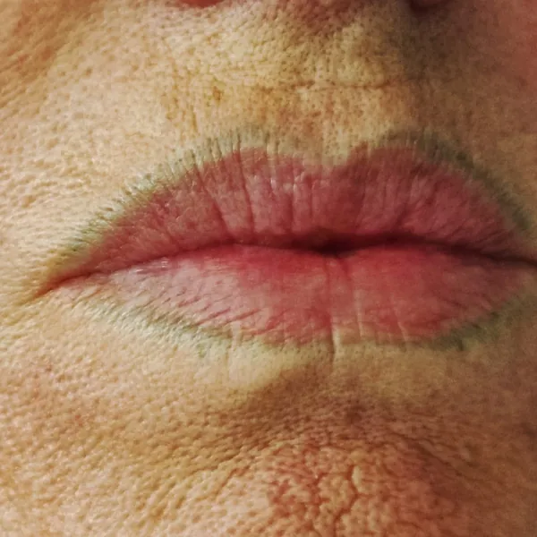 Lip liner before removal
